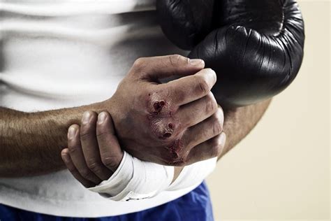 boxing metal injury|common injury for a boxer.